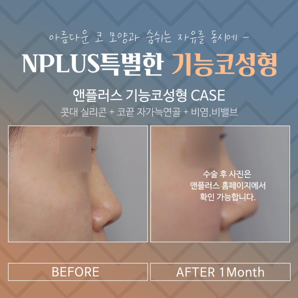 기능코후기에 대한 비교를 찾아보고 관련 이미지 14