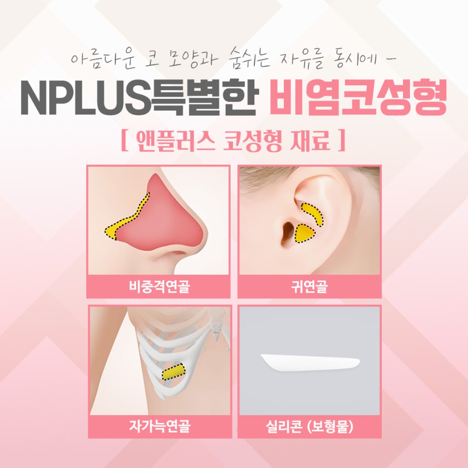 비염수술후기에 대한 정보를 알아보고 관련 이미지 9