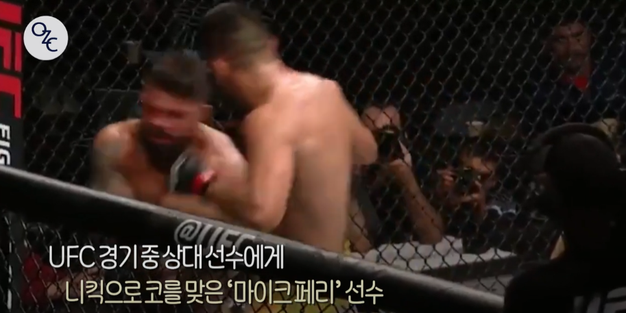 코뼈골절의 원인과 수술 방법에 대하여 관련 이미지 2