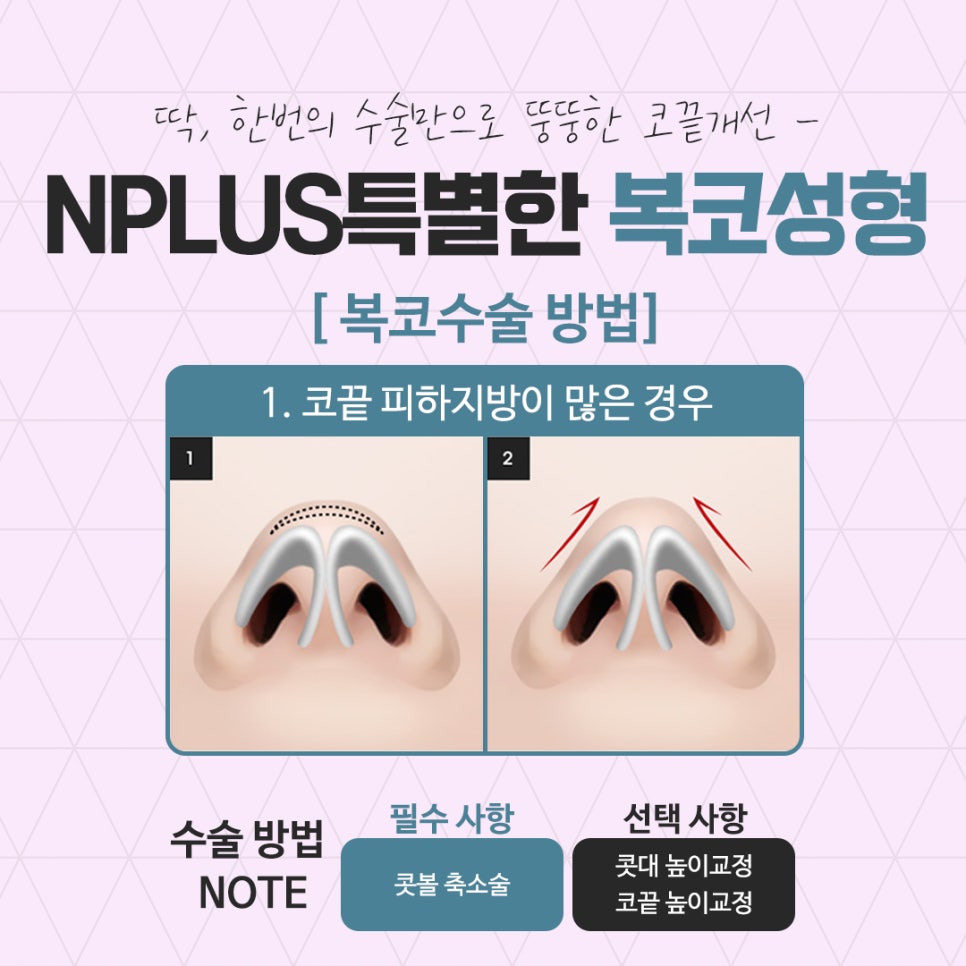 Be Sure to Learn About Bulbous Nose Surgery Reviews image 9