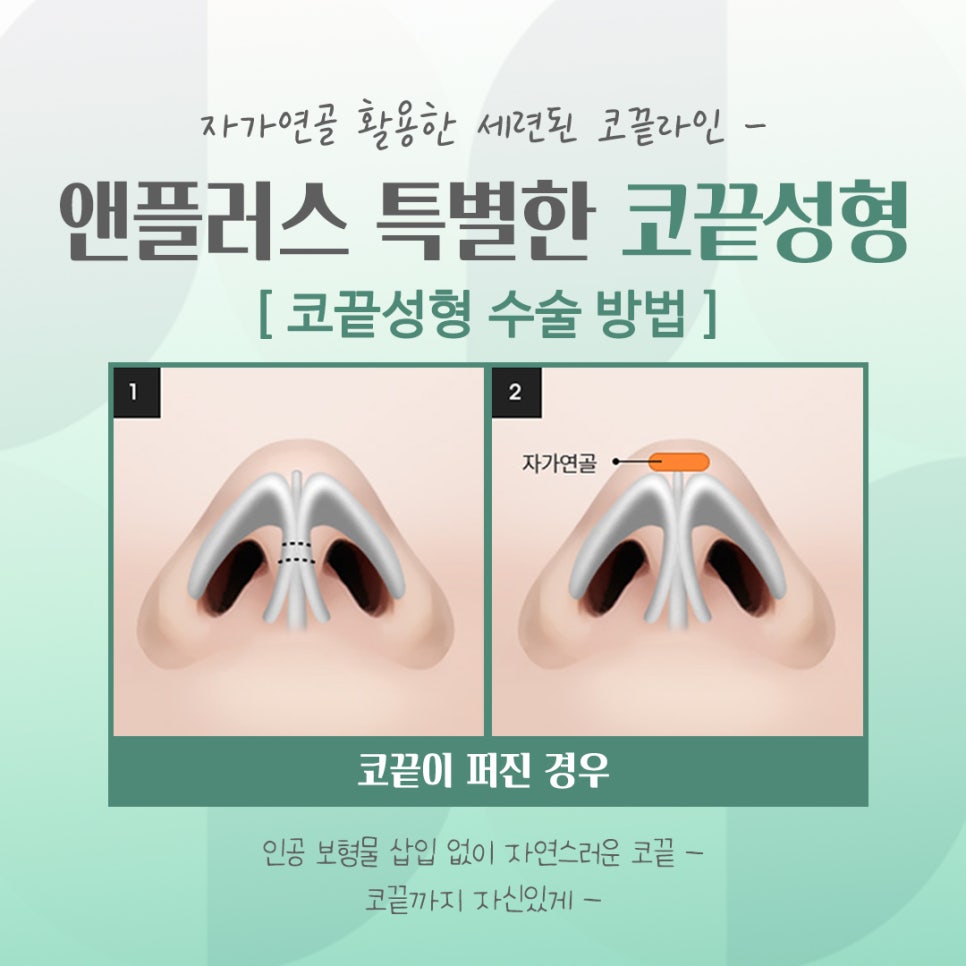 코끝성형후기를 확인하고 자연스럽게 교정하여 관련 이미지 10