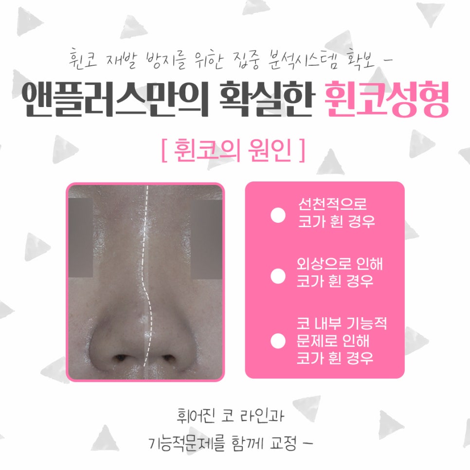 휜코수술후기를 자세하게 알아보고 관련 이미지 4