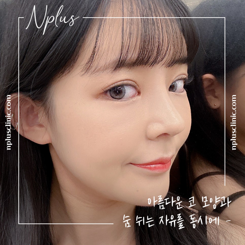 늑연골코성형을 고민한다면 관련 이미지 2