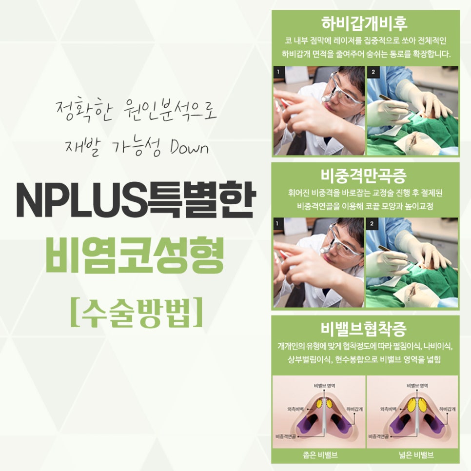 비염수술코성형 다양한 요인을 확인하여 관련 이미지 10
