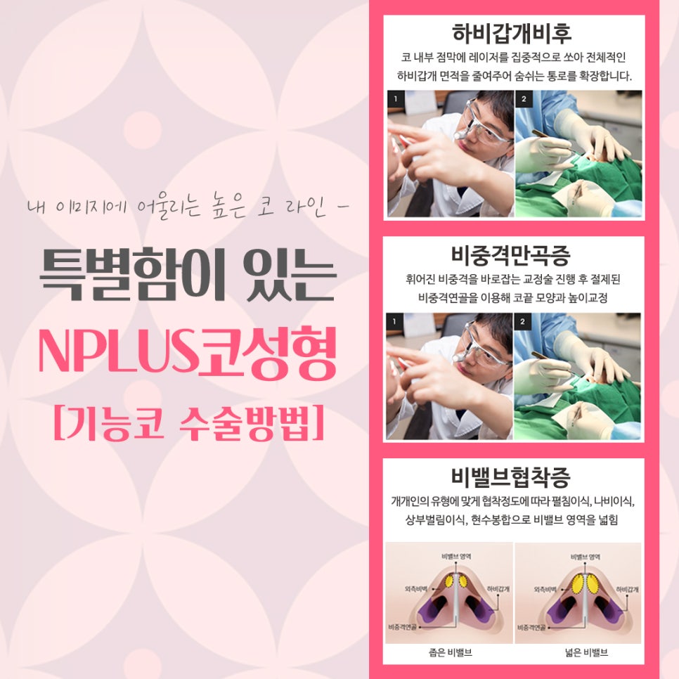 서울코수술잘하는곳 꼼꼼하게 알아보고 관련 이미지 10