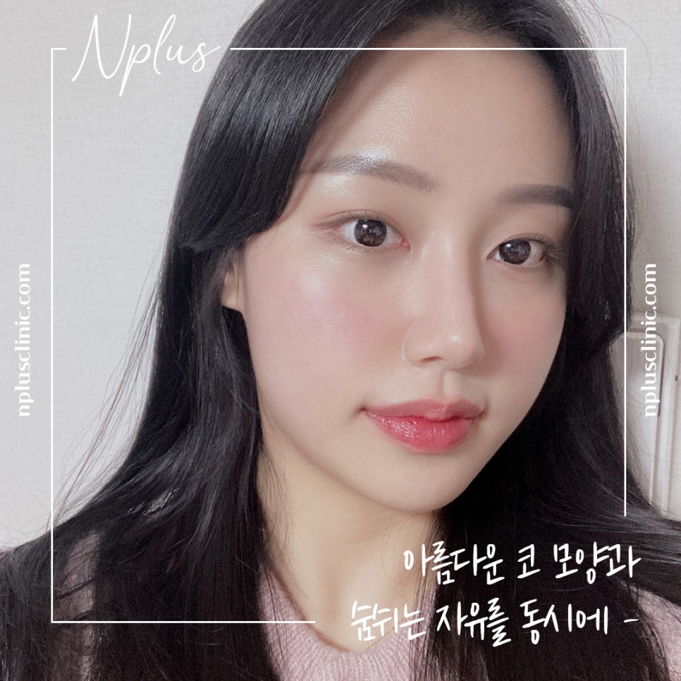 콧볼축소후기 원인을 정확하게 알아보고 관련 이미지 1