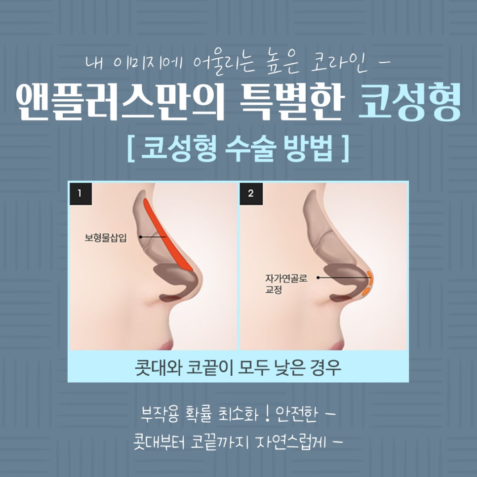 코수술전후 기능까지 확인하고 관련 이미지 8