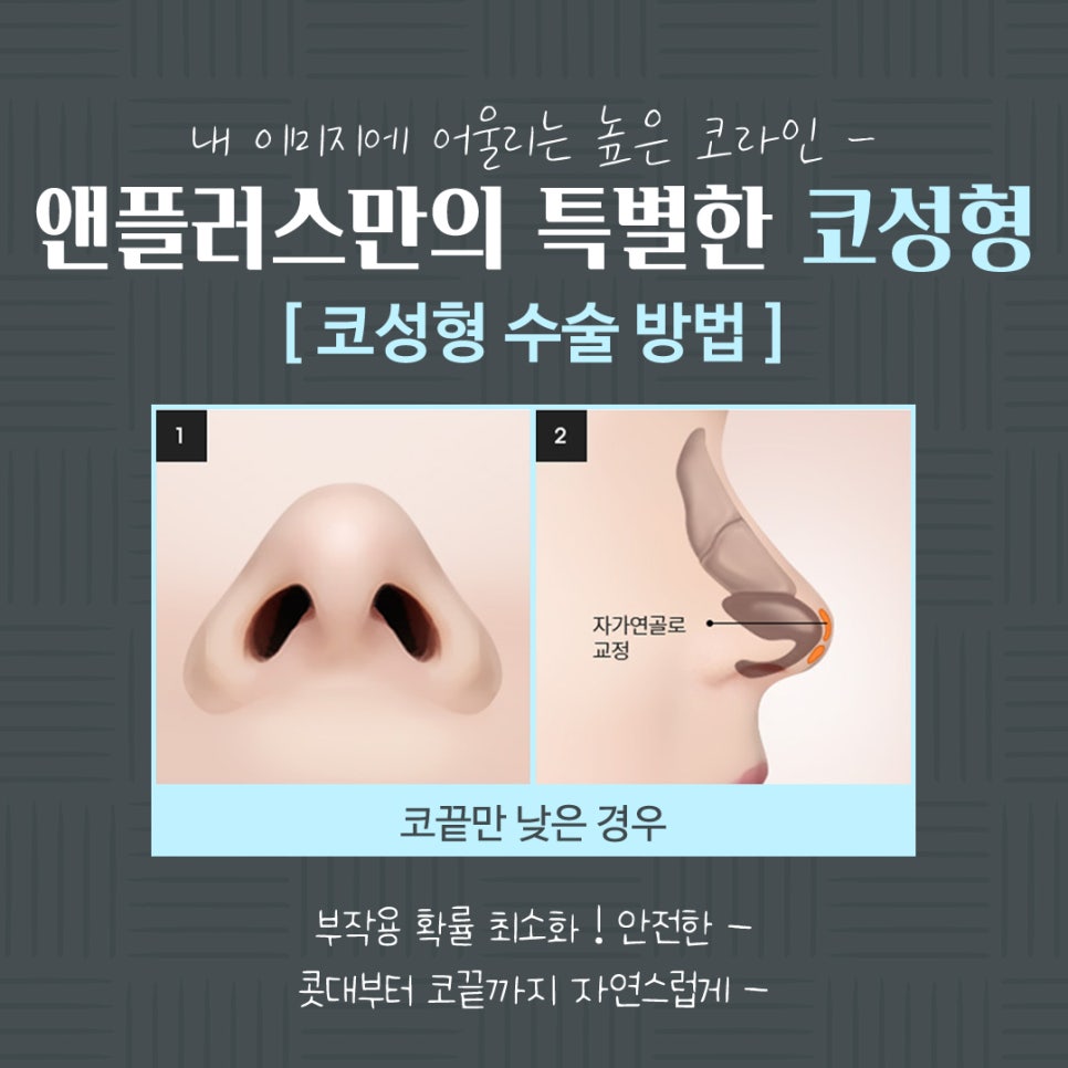 코수술전후 확실한 차이 관련 이미지 9