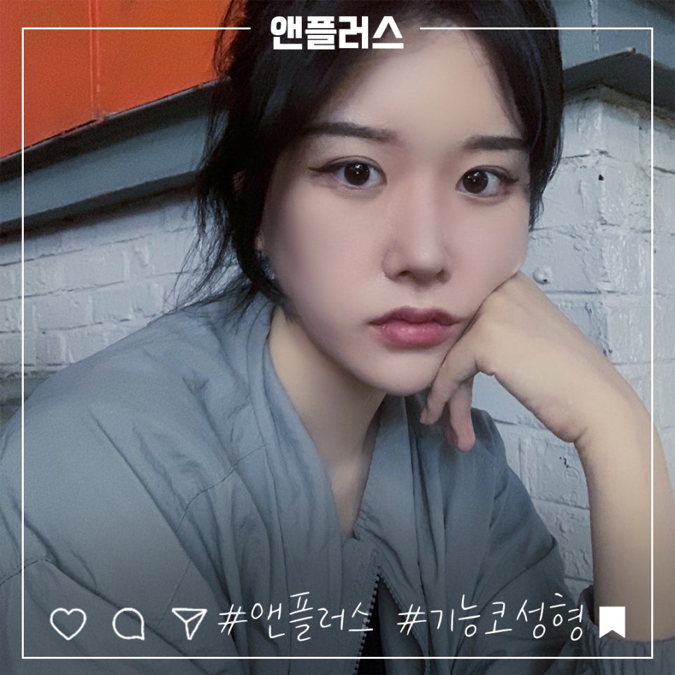코성형후기 자연스럽고 예쁘게 관련 이미지 1
