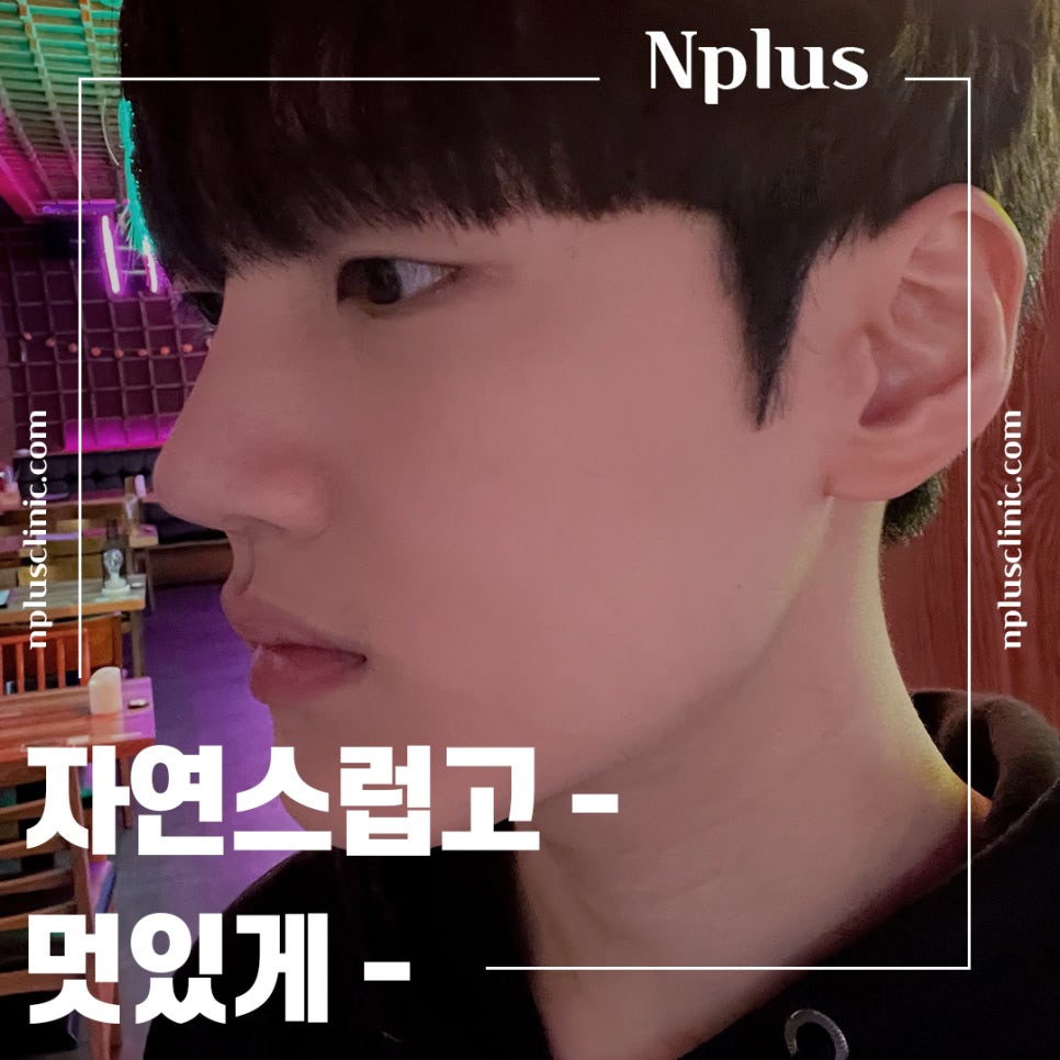 남자성형 자연스럽고 멋있게 관련 이미지 1