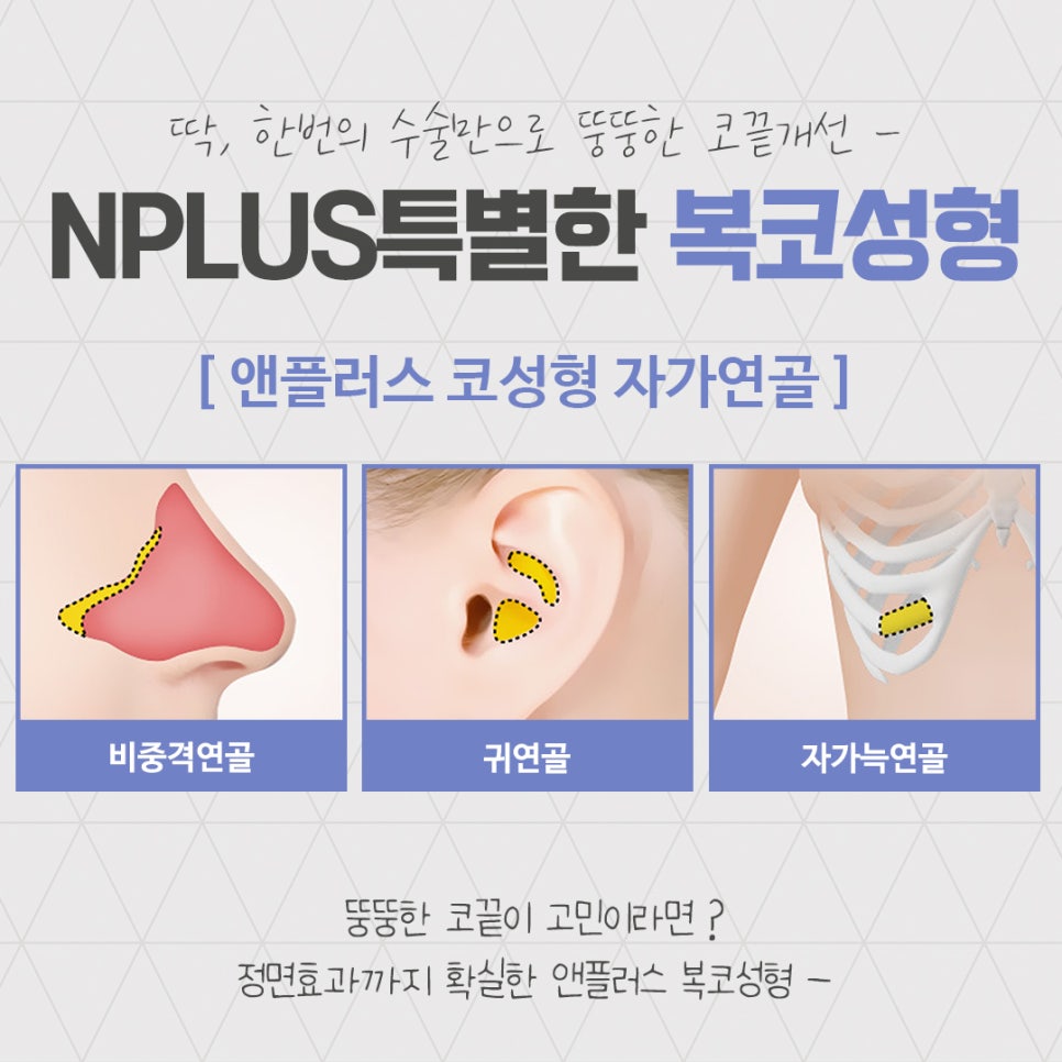 복코성형후기로 알아보는 코지방제거 관련 이미지 10