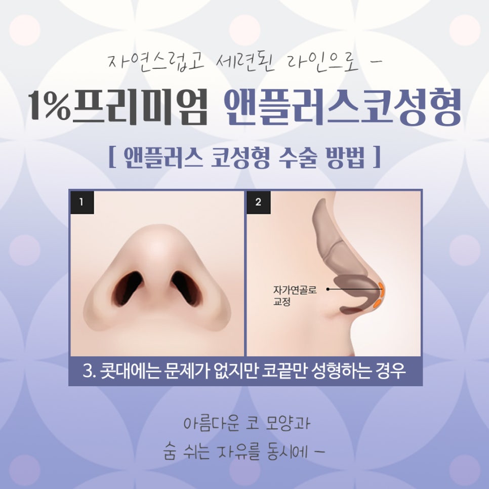 자가늑코수술 내게 어울리는 라인으로 관련 이미지 10