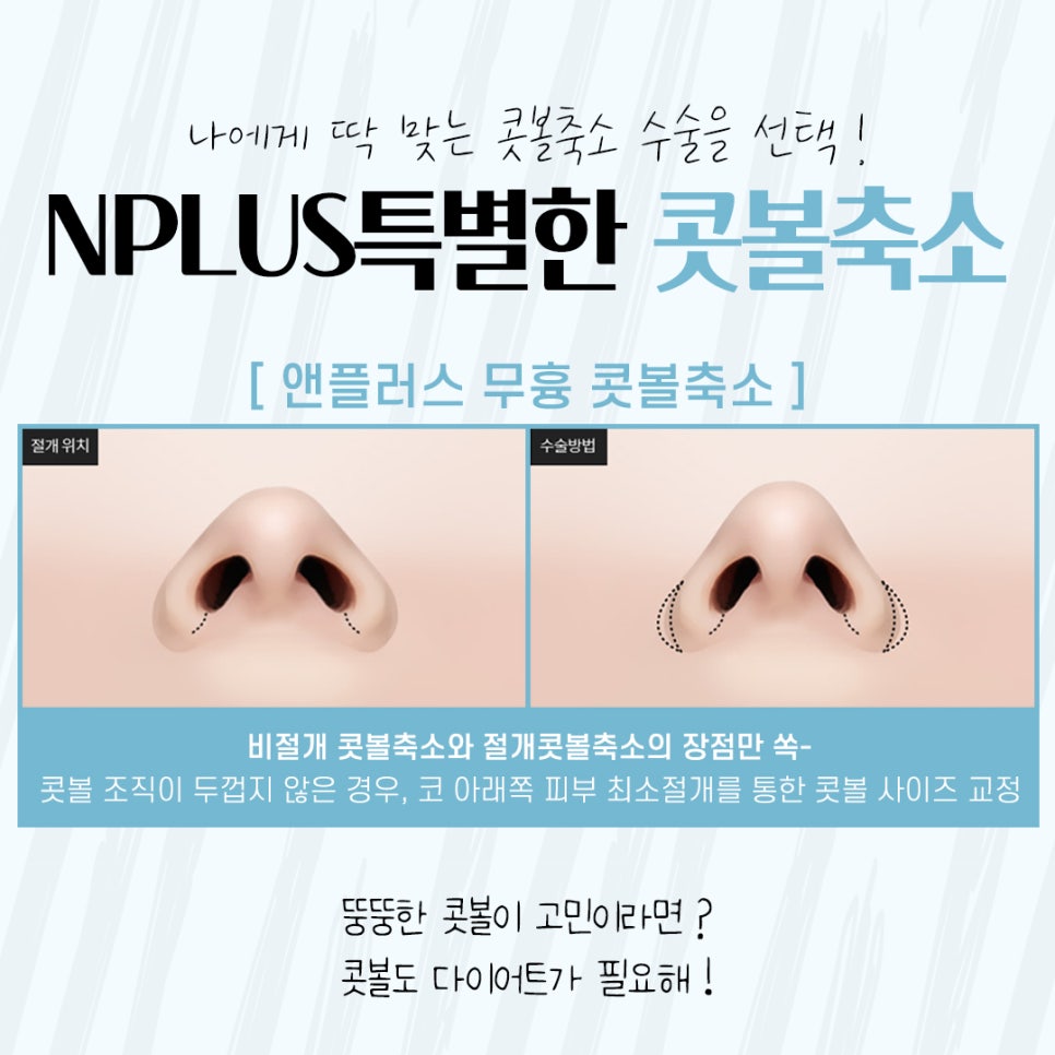 Natural Progress in Nasal Alar Reduction Surgery Review image 7