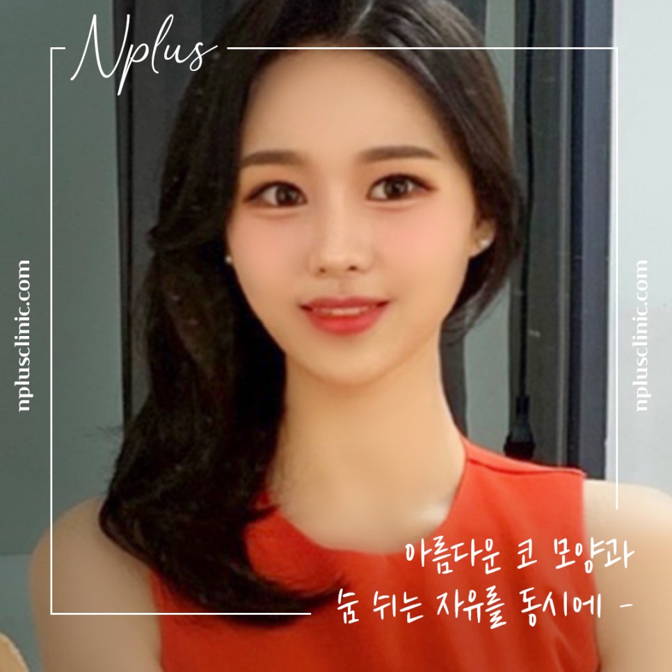 자가늑연골코성형의 필요성 관련 이미지 2
