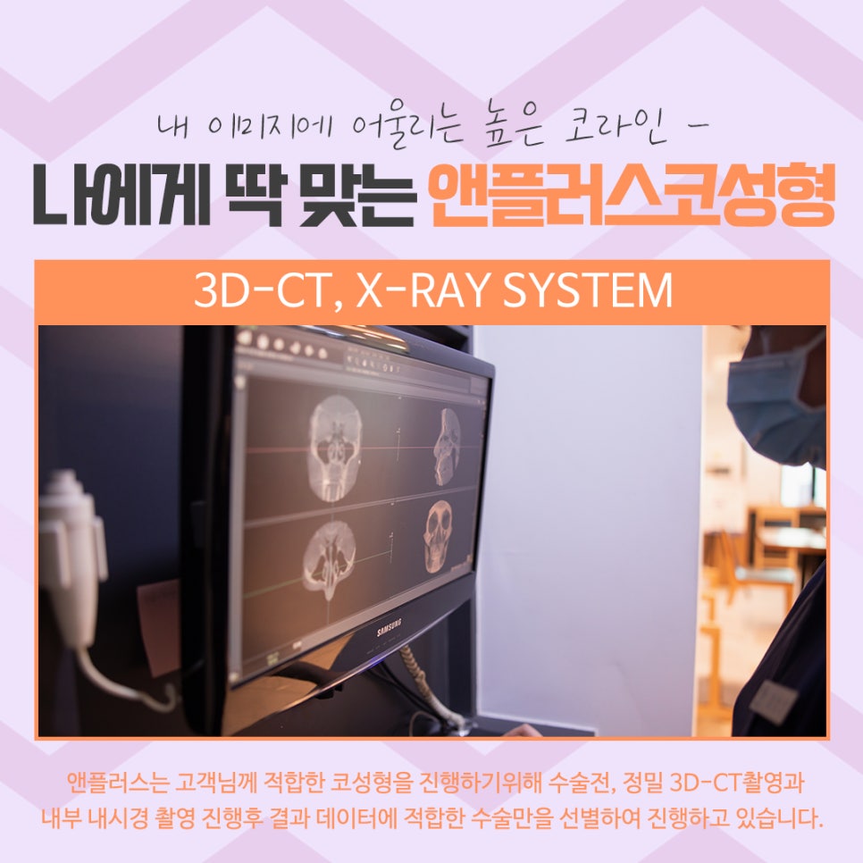 코수술후기 코 내부까지 확실하게 알아보고 관련 이미지 6