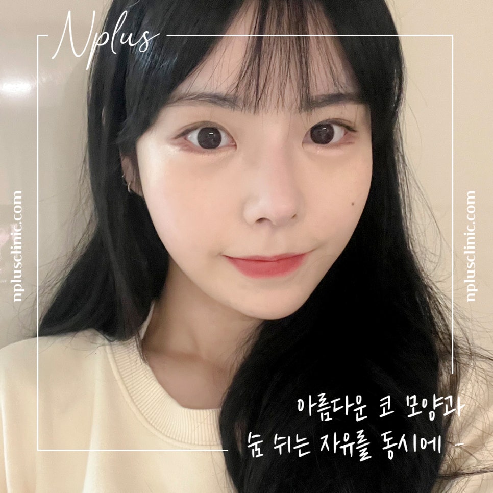 Accurately Reviewing Rhinoplasty Experience image 2