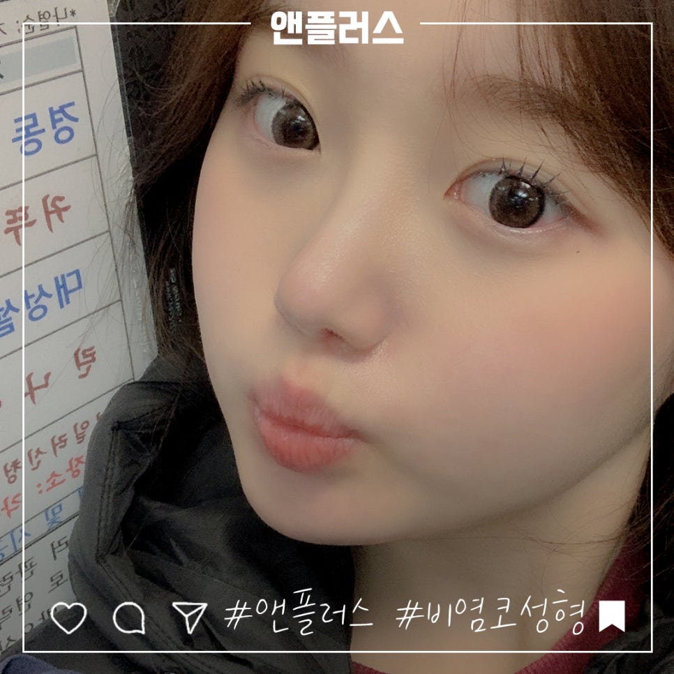비염코성형후기 원인을 자세하게 알아보고 관련 이미지 4