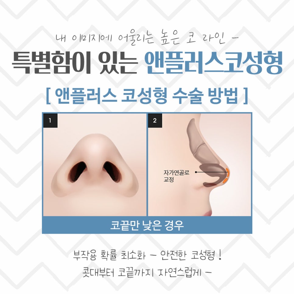 Nose Surgery Review: A Thorough Look Inside image 10