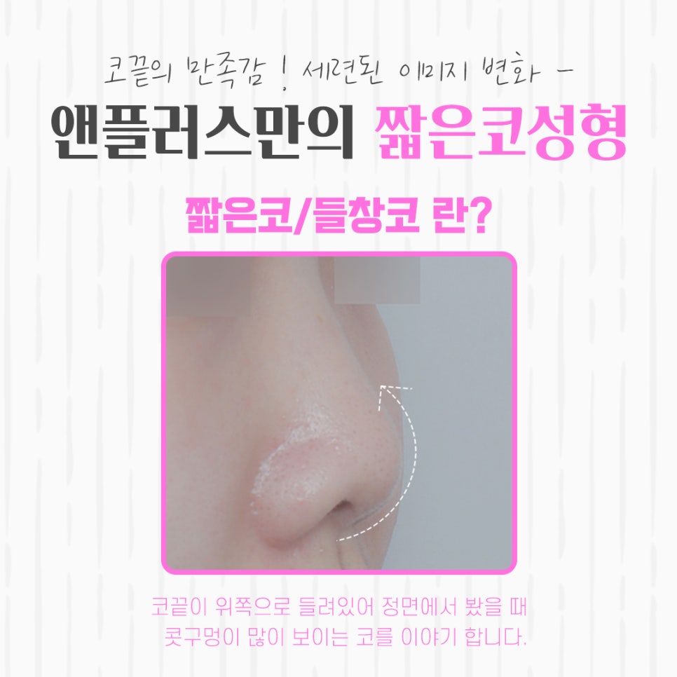 짧은코성형을 통해 세련된 이미지로 관련 이미지 3