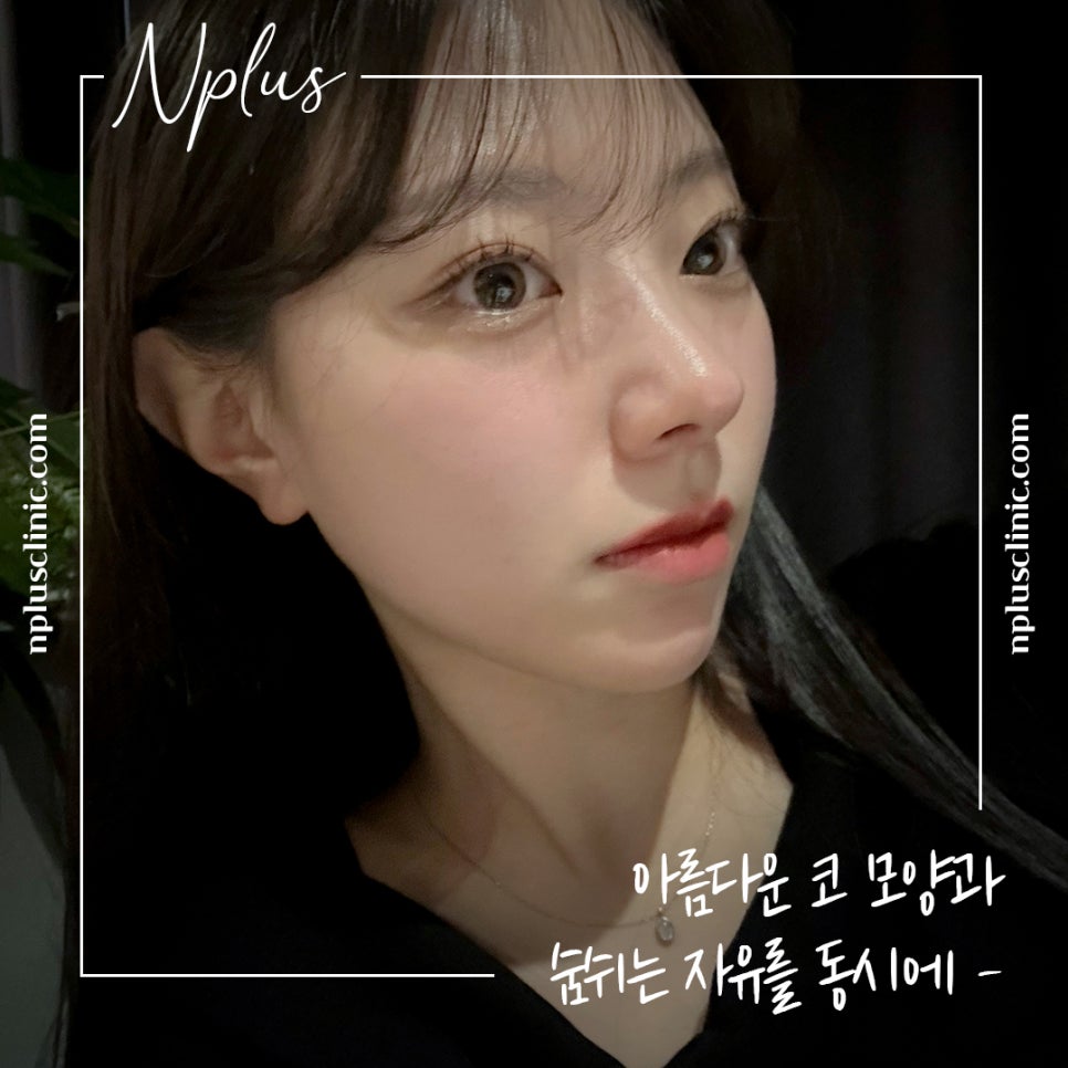 화살코수술 자세하게 알아보고 관련 이미지 1