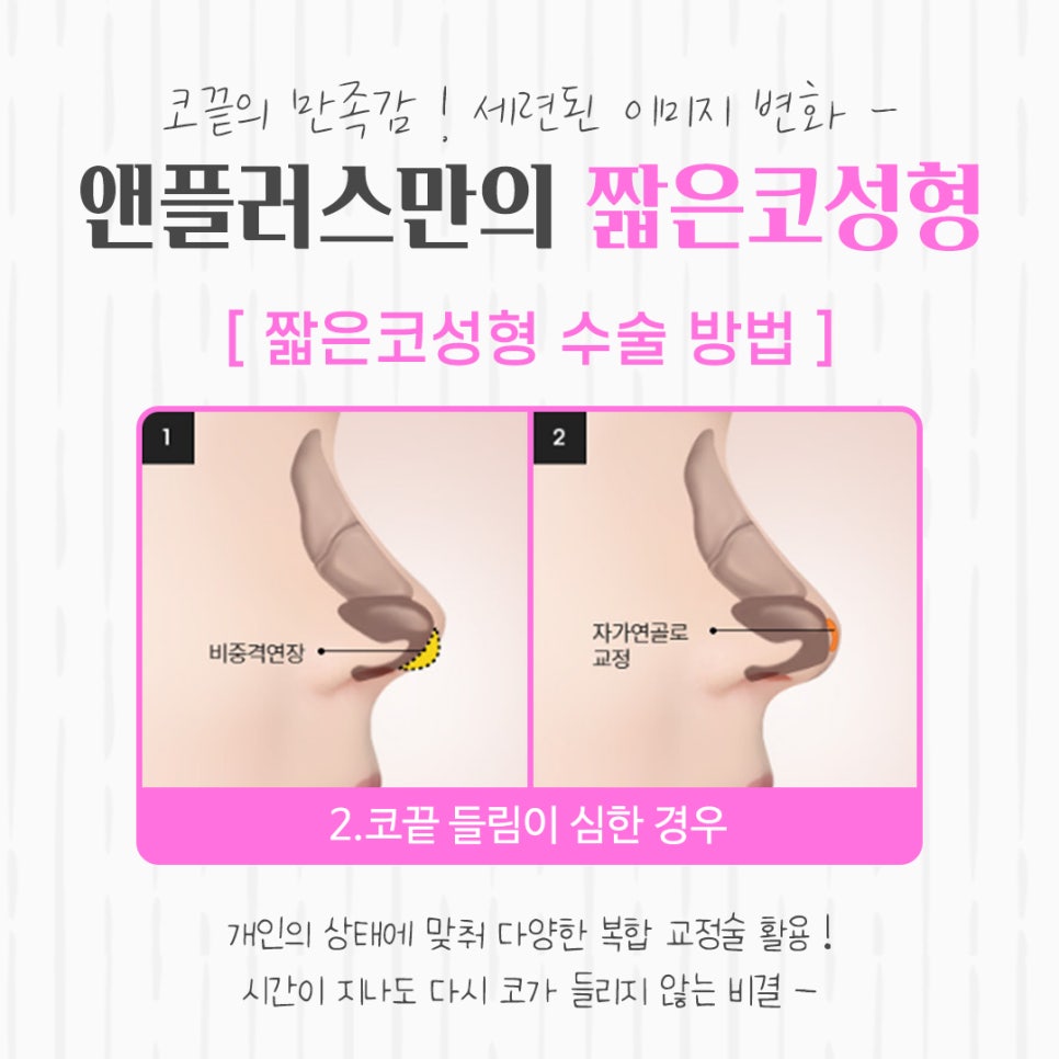 짧은코성형을 통해 세련된 이미지로 관련 이미지 9