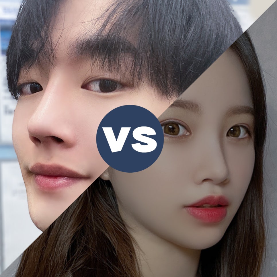 Male Rhinoplasty Review: Taking Functional Aspects into Consideration image 4
