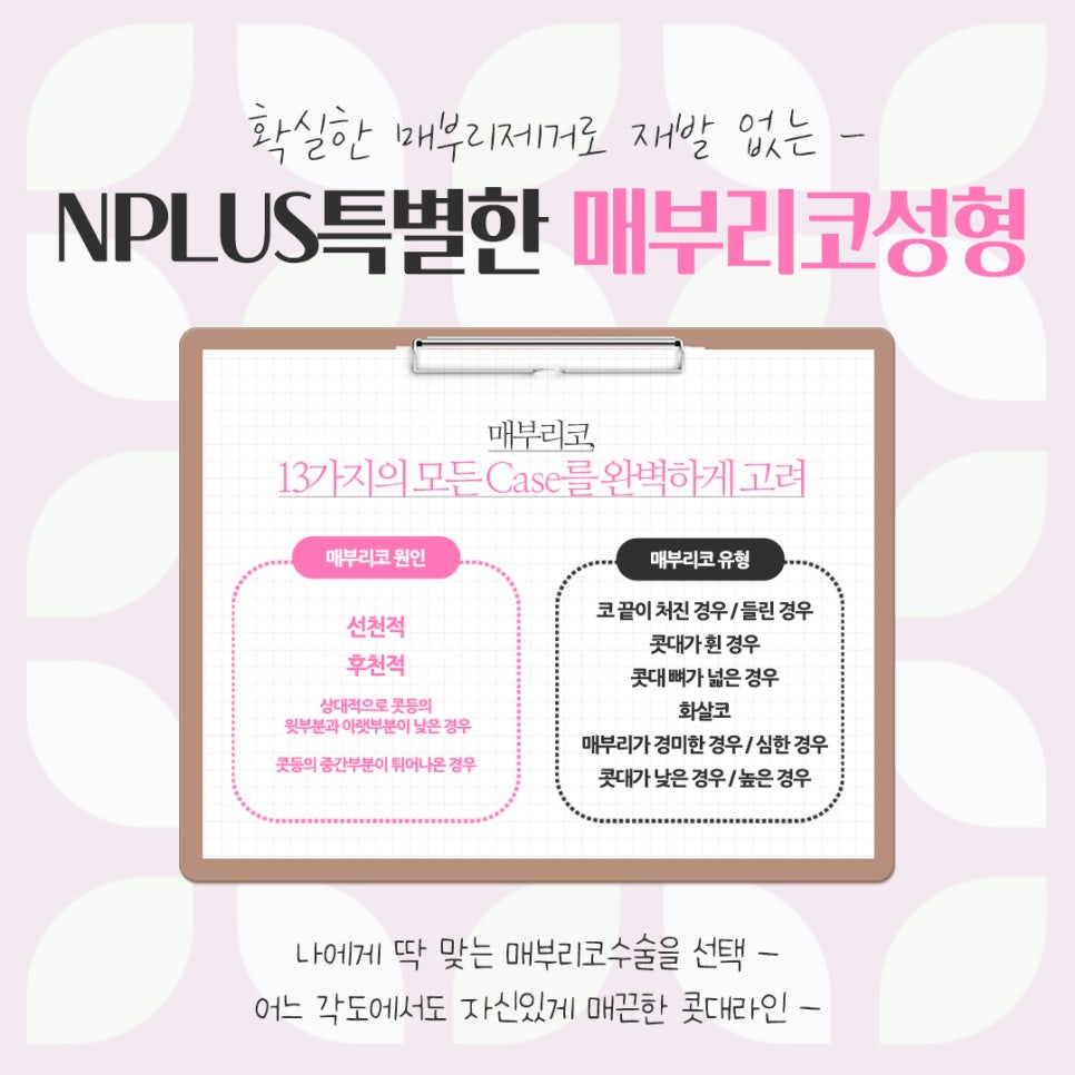 매부리코성형후기를 통해 이미지 개선 관련 이미지 4