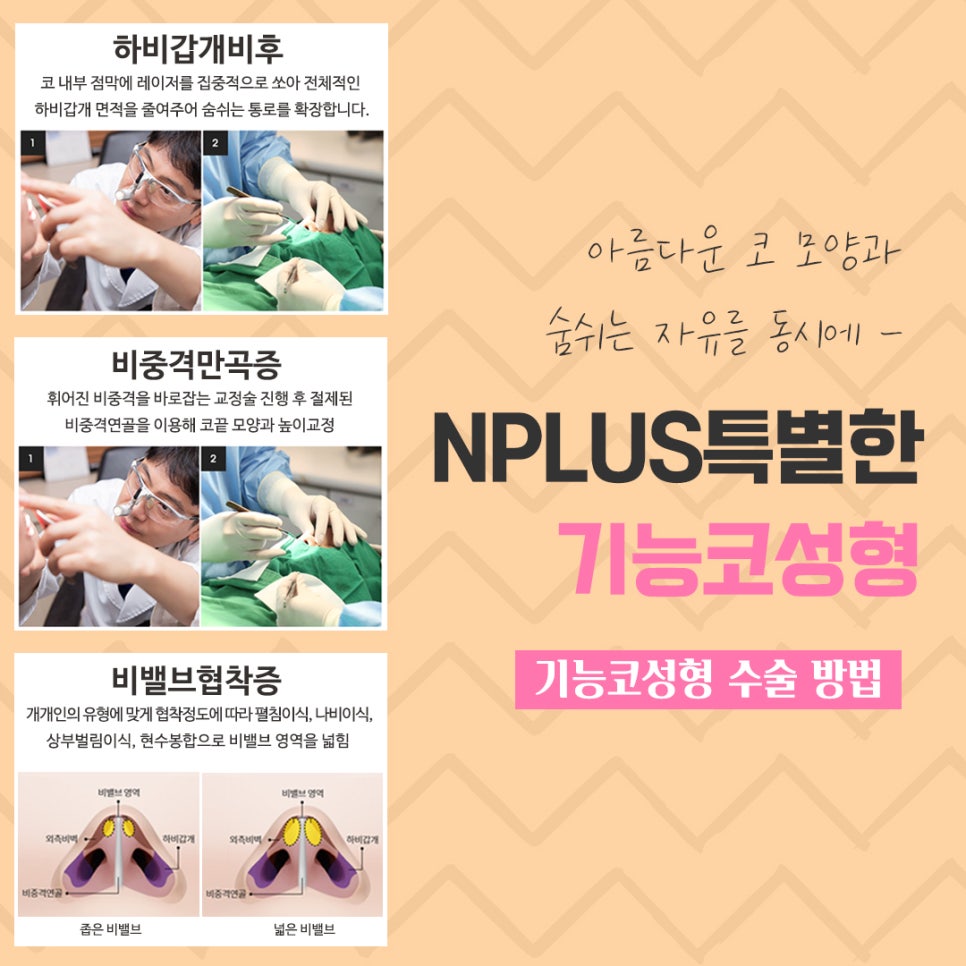 Functional Nose Surgery Reviews with Improved Nasal Line image 11