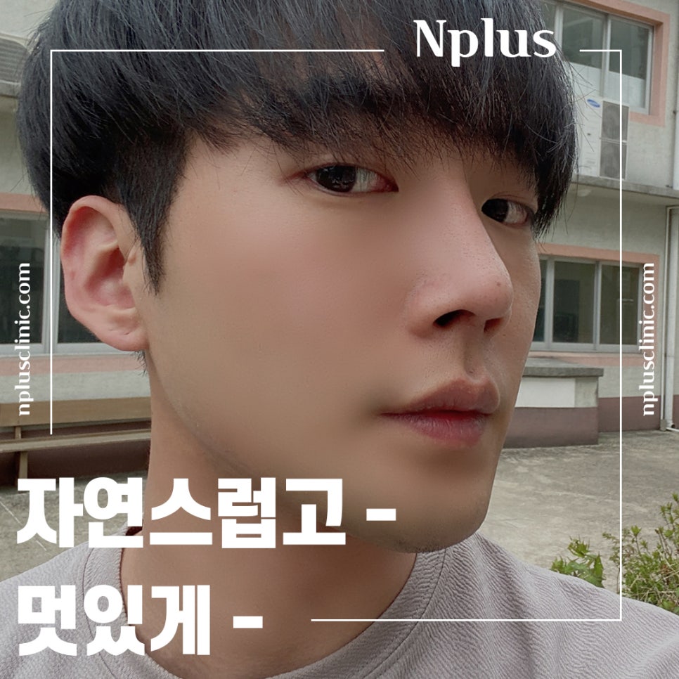 남자코성형후기 자세하게 알아보고 관련 이미지 3