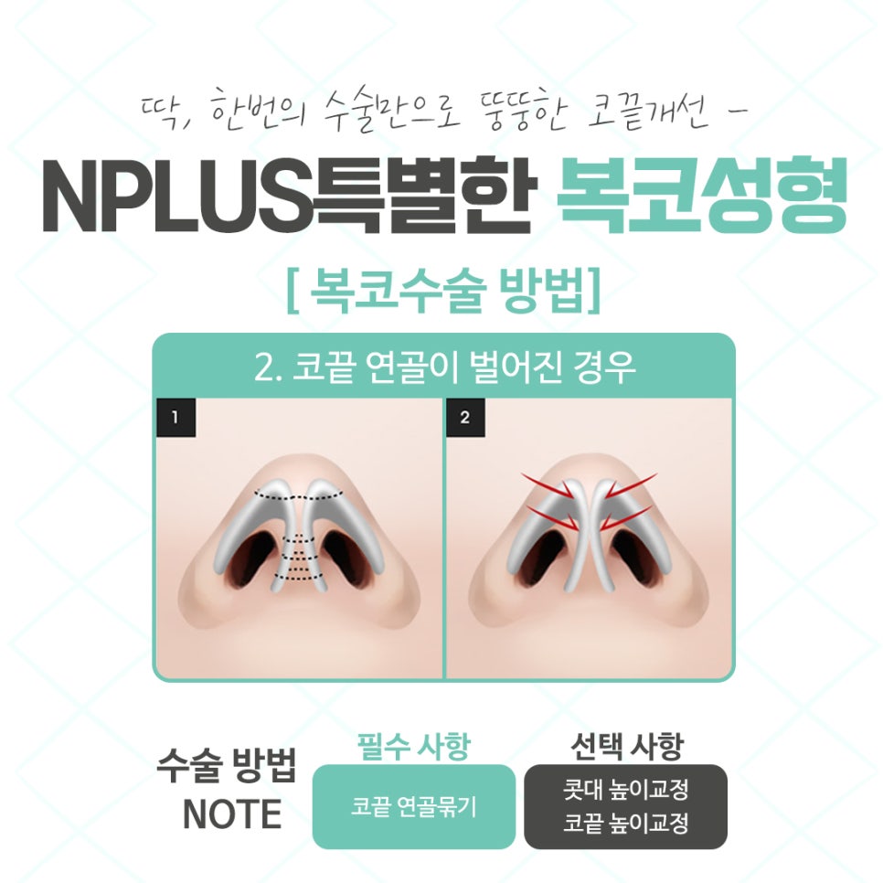 When Looking at Bulbous Nose Surgery Reviews image 9