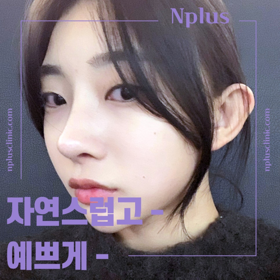 압구정코수술에 대해 찾아보고 관련 이미지 2