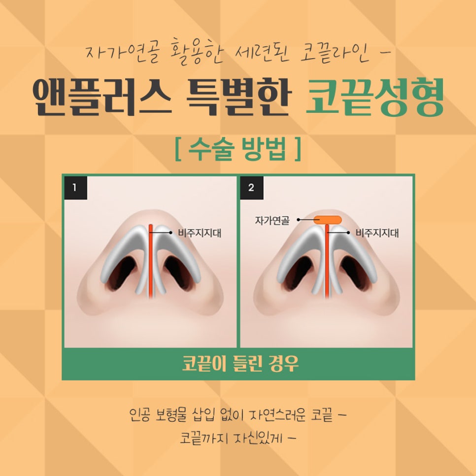 Nose Tip Surgery Review Found at Gangnam & Plus image 9