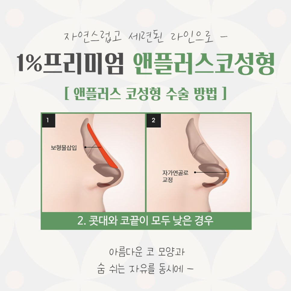 자가늑코수술에 대해 자세히 찾아보고 관련 이미지 9
