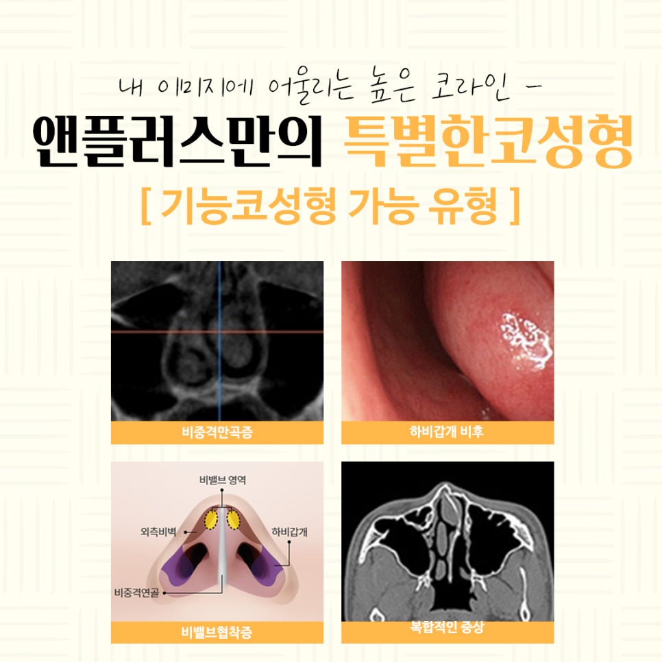 Autologous Cartilage Rhinoplasty for a Natural Nose Line image 10