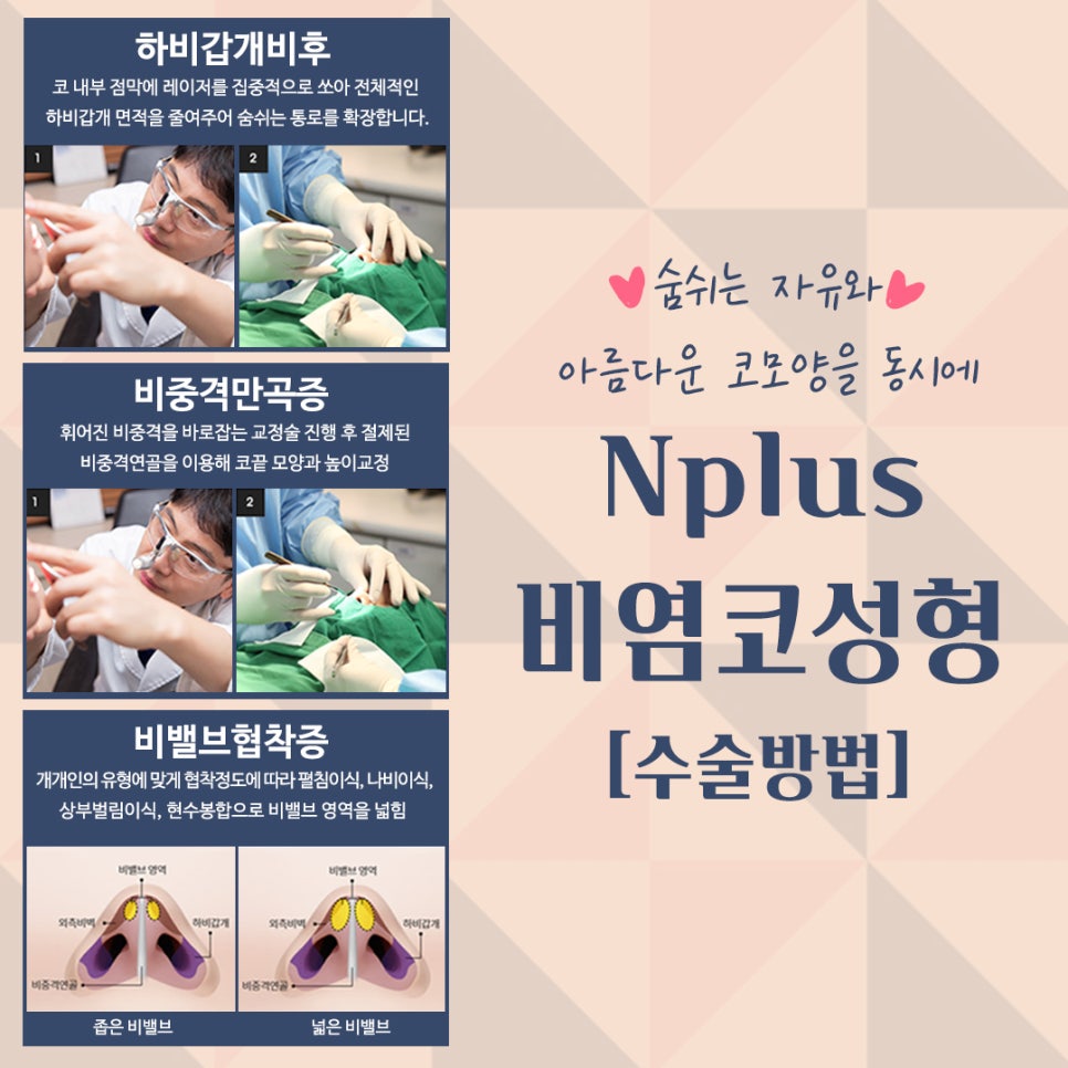 비염수술 정확한 진단으로 관련 이미지 5