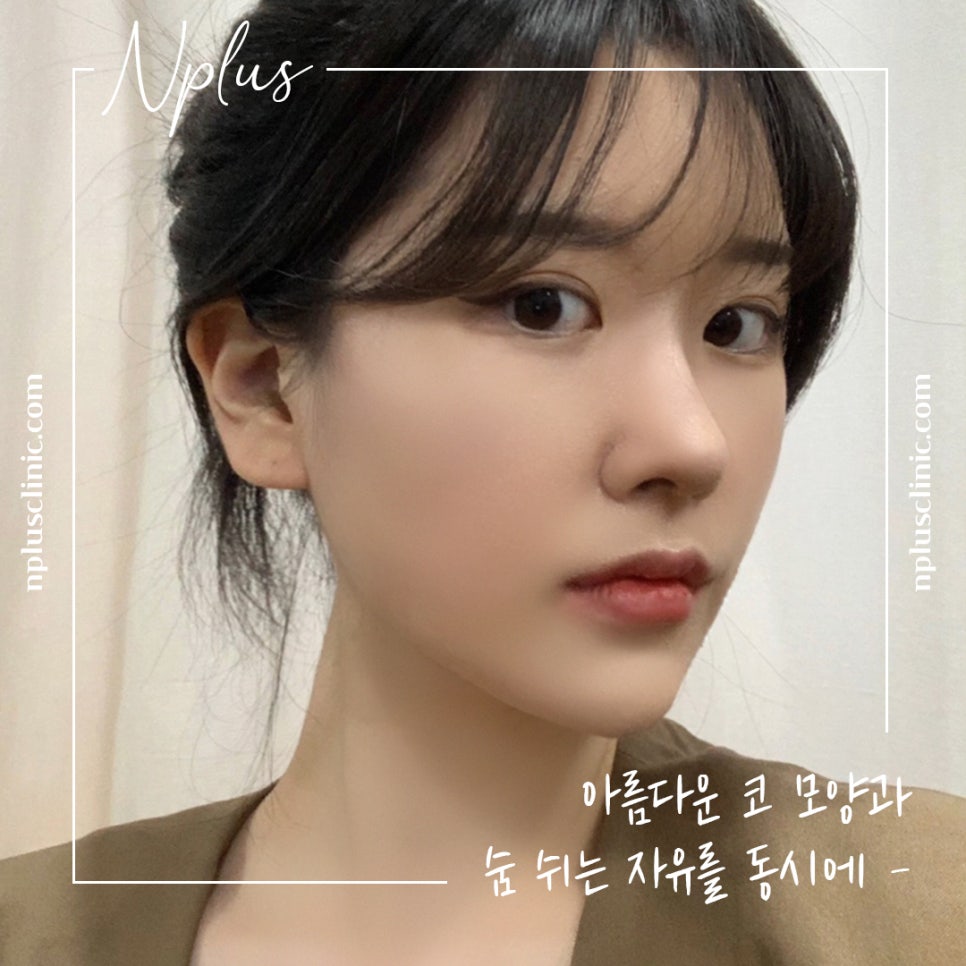 코수술후기 라인까지 고려해서 관련 이미지 2