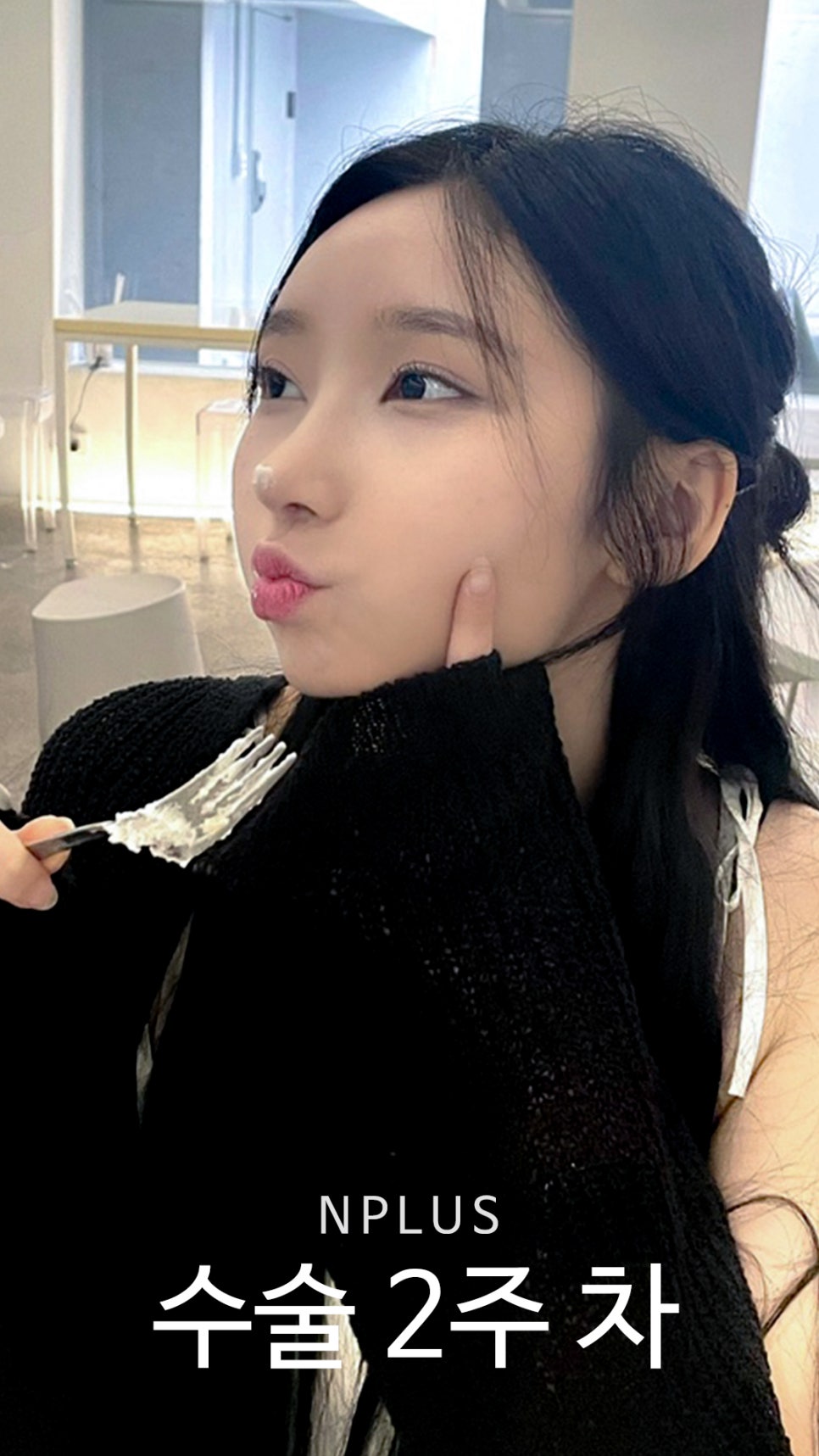 기본코성형후기 절골 + 무보형물 코성형 + 코끝 비중격 연골, 귀 연골 관련 이미지 6