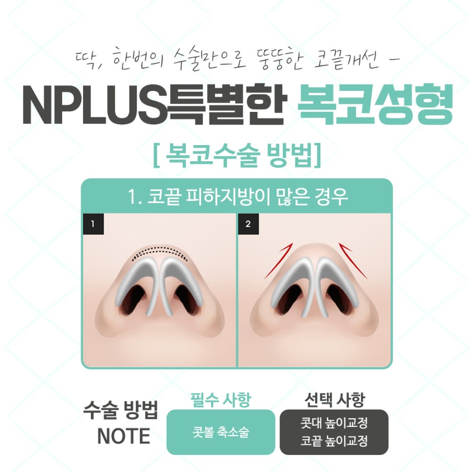 When Looking at Bulbous Nose Surgery Reviews image 8