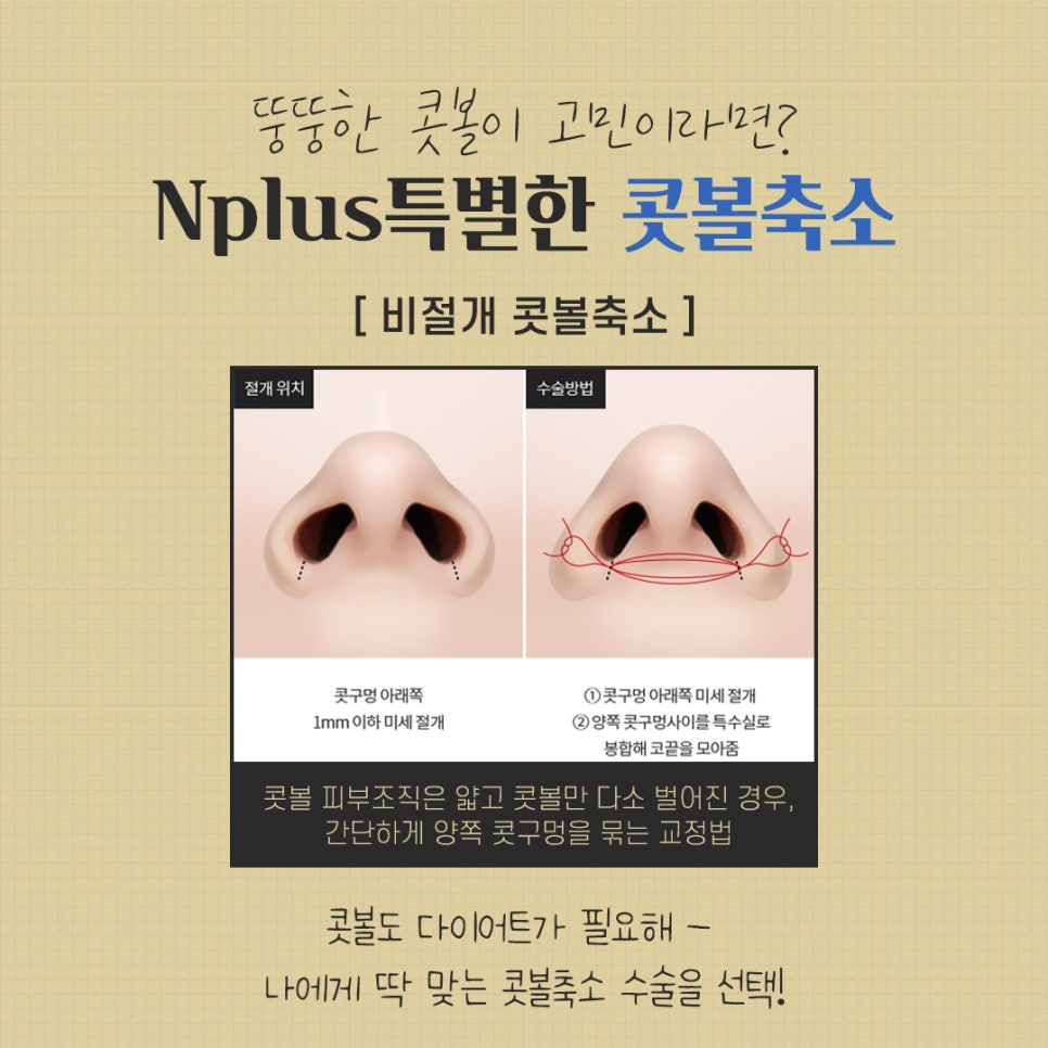 Review of Nostril Reduction to Improve a Wide Nose image 7