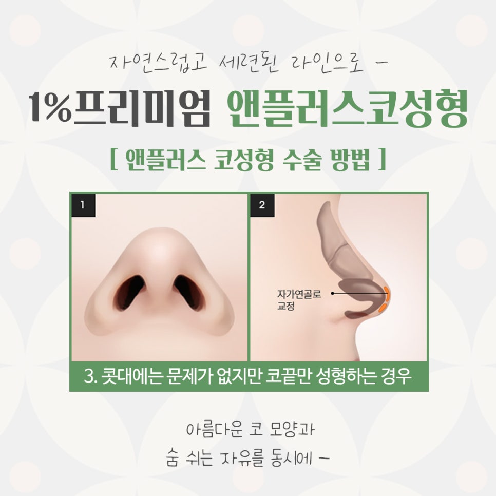 자가늑코수술에 대해 자세히 찾아보고 관련 이미지 10