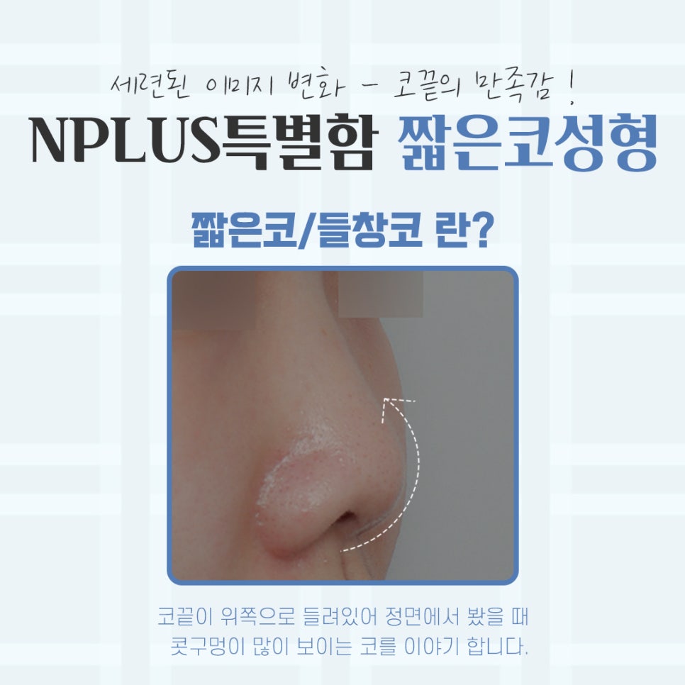 짧은코성형후기 자연스럽고 예쁘게 관련 이미지 3