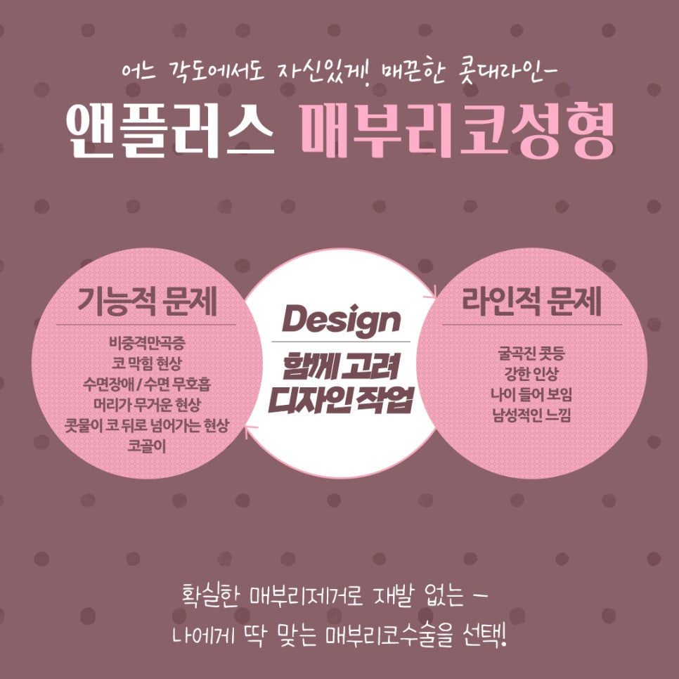 코끝처짐 개선한 매부리코성형후기 관련 이미지 6