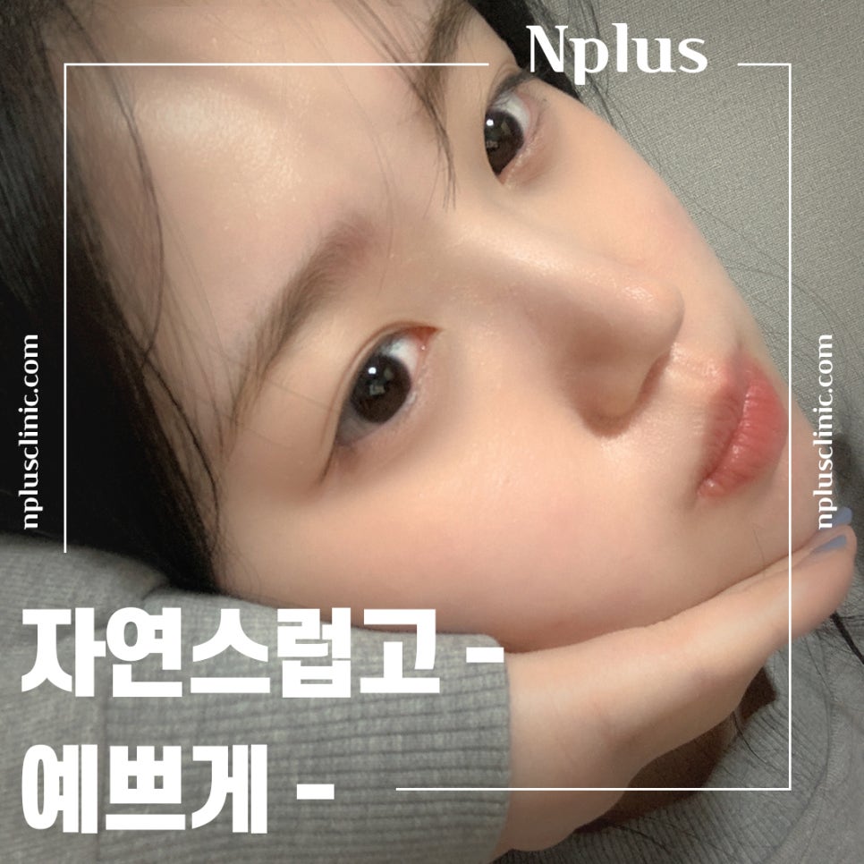 매부리코수술후기 확인하고 부드러운 인상으로 관련 이미지 9
