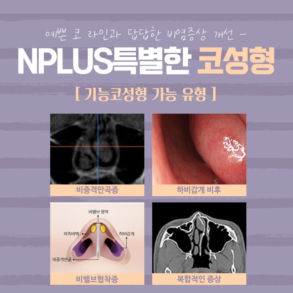 A Nose Surgery Review That Accurately Checks Function Too image 6