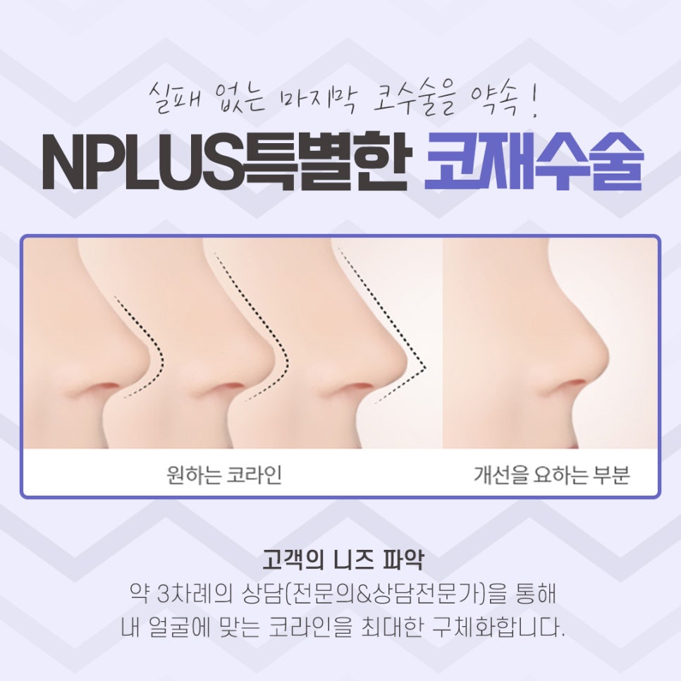 코재수술 후기까지 확실하게 관련 이미지 5