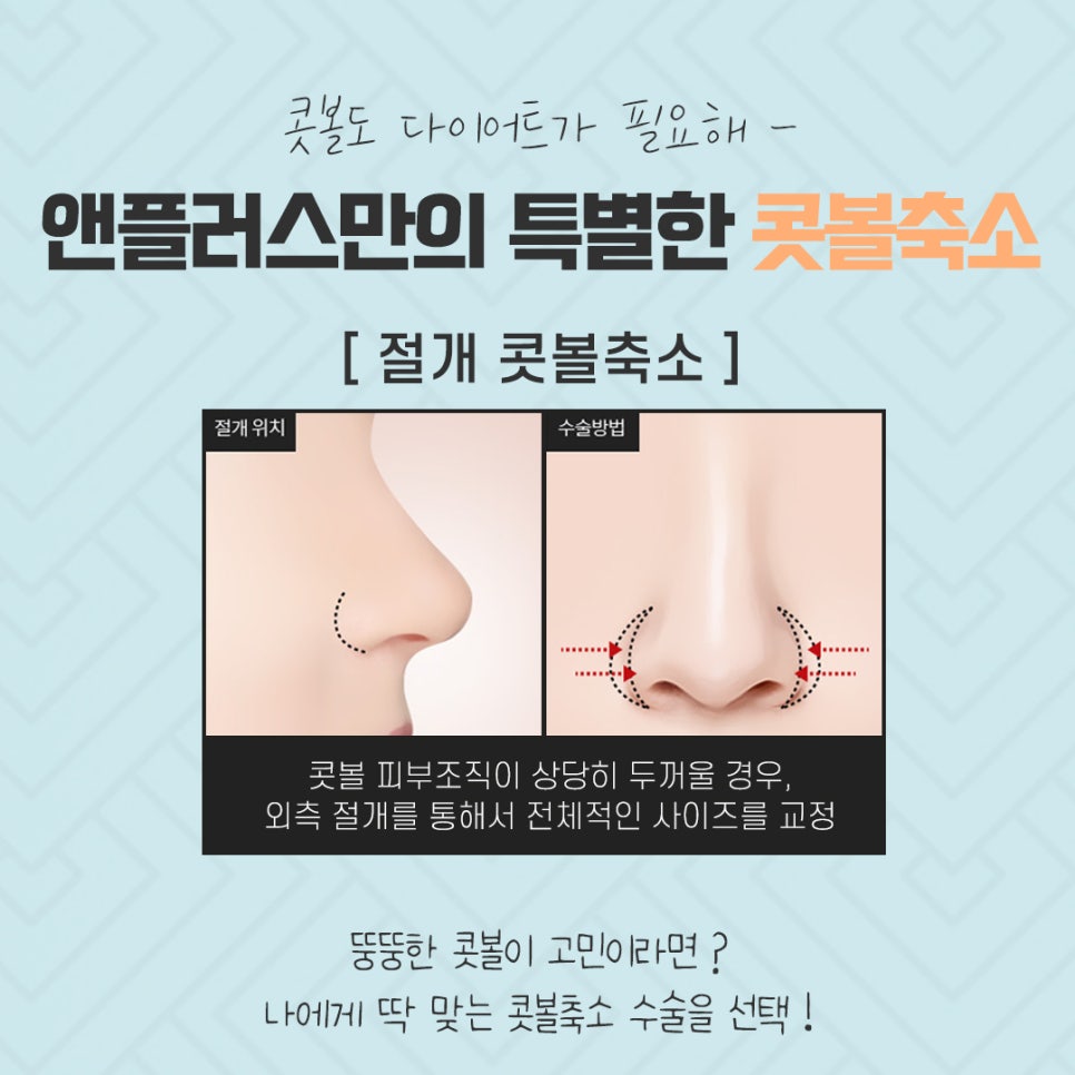 콧볼축소수술 흉터 없이 강남앤플러스에서! 관련 이미지 10