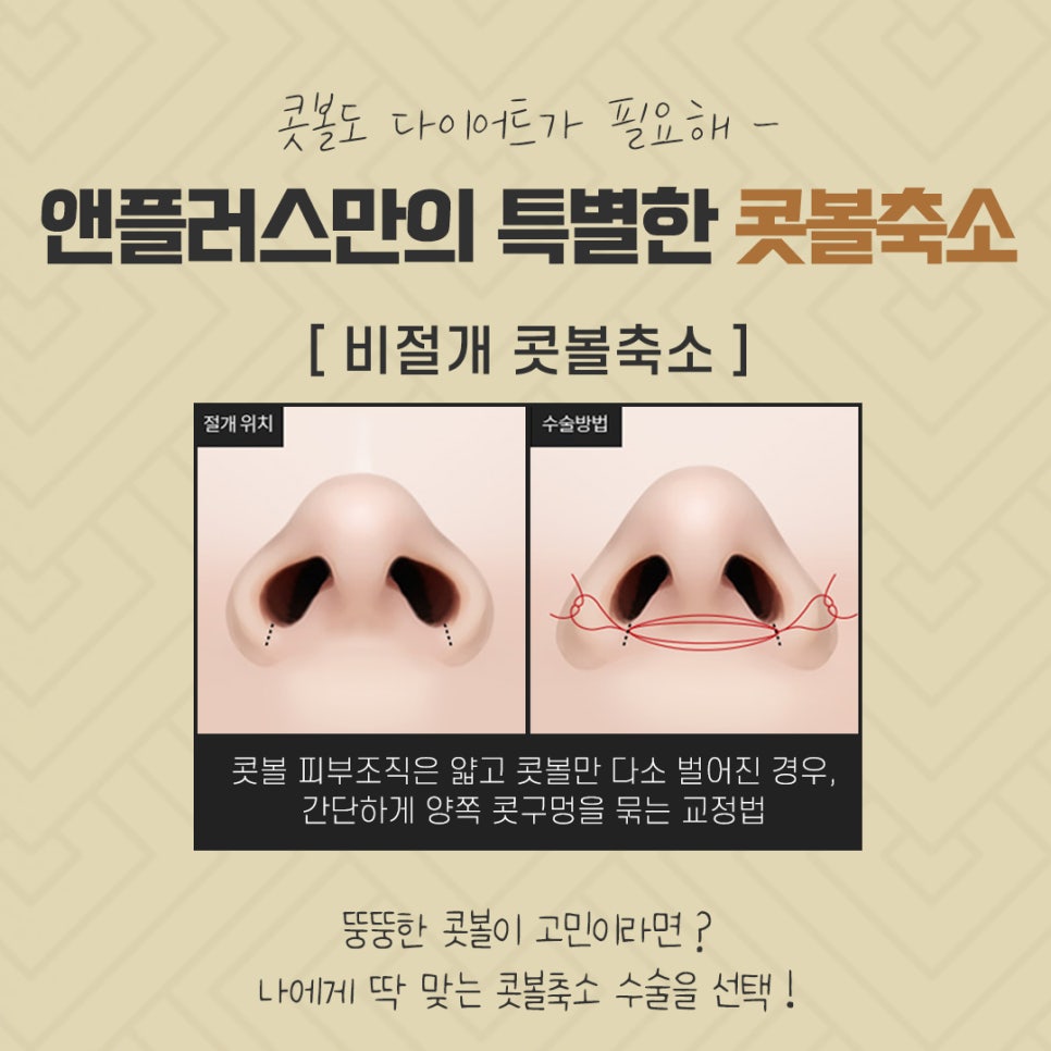 Nasal Ala Reduction Review: Research Carefully Before Deciding image 9