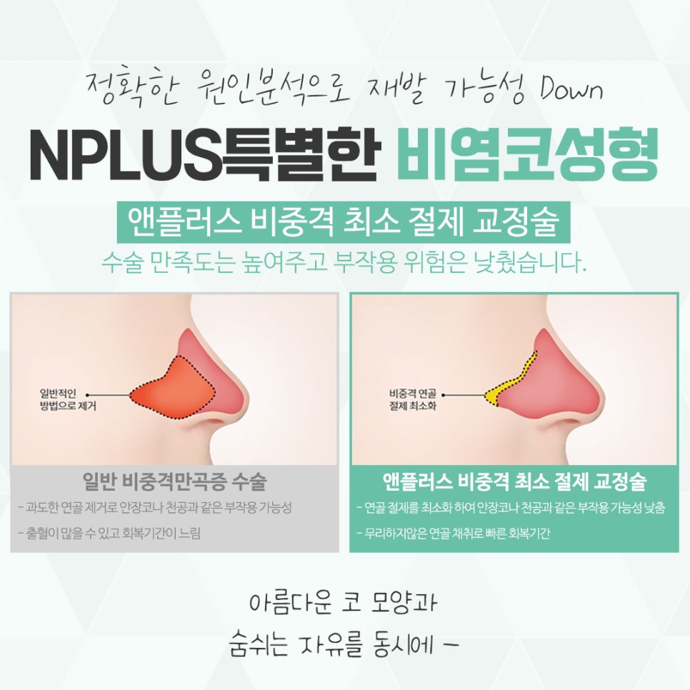 Check Nasal Surgery and Rhinoplasty in Detail image 11