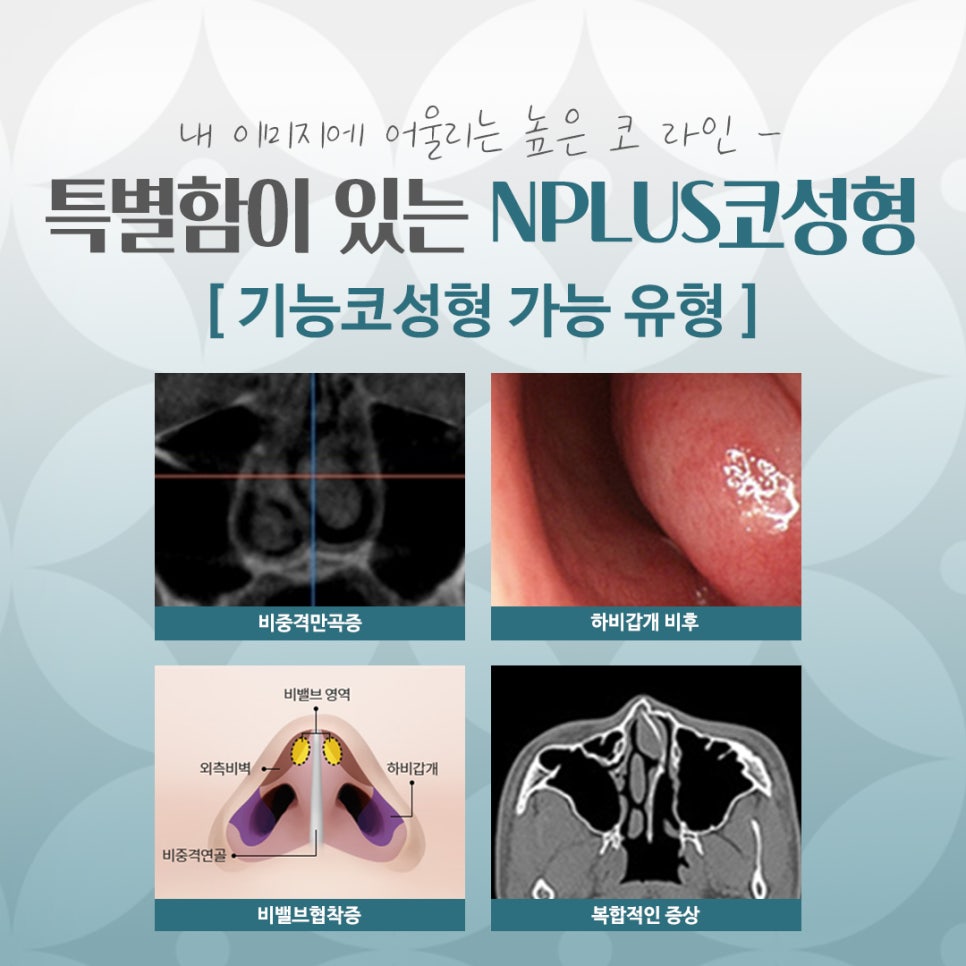 Looking Into Information About Gangnam Nose Surgery image 5