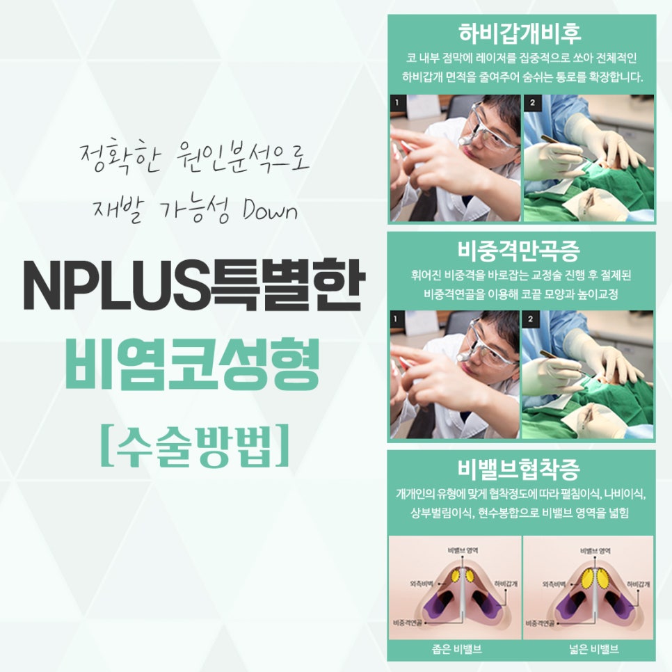 Check Nasal Surgery and Rhinoplasty in Detail image 9